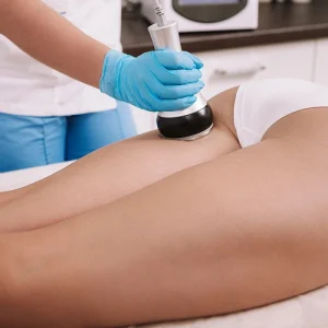 Reducción de celulitis